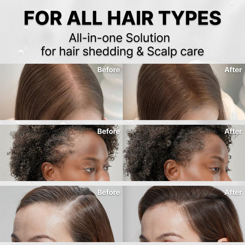 Korea's #1 Hair Growth Serum