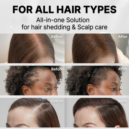 Korea's #1 Hair Growth Serum